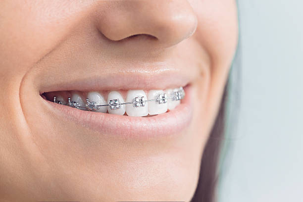 Best Dental Bonding  in Fowlkes, TN